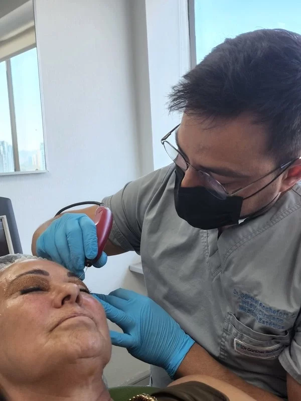 Aplicación Plasmage Blefaroplastia