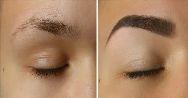 Antes y despues Cejas